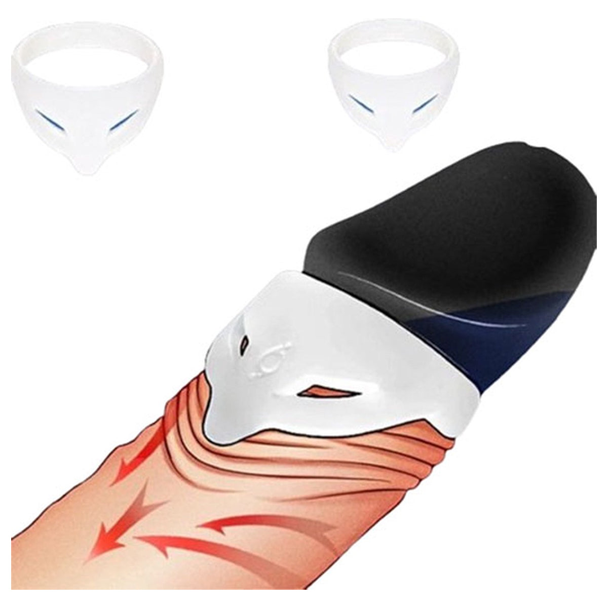 Eikel Voorhuid Correctie